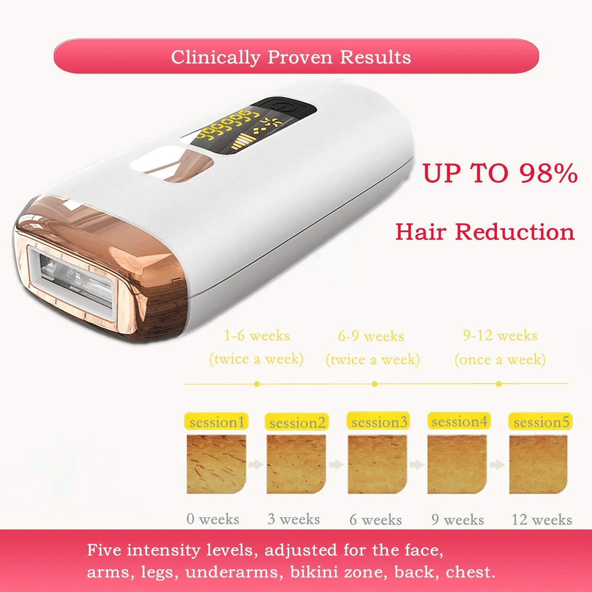 IPL Hair Removal with Cooling System U4194